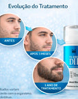 Turbodil Beard Blend Embaixador 30ml