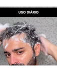 Shampoo Anticaspa Nerk Therapy Embaixador 240ml